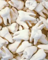 what does a tooth cavity look like