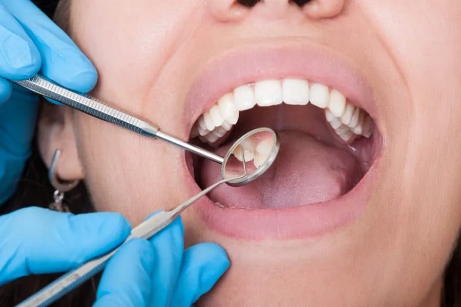 Taking Care of Your Mouth With Preventive Dentistry