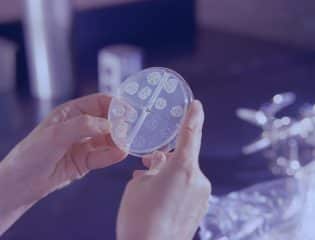 Trichomoniasis test