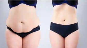 Seven Ways to Change Your Diet after Weight Loss Surgery