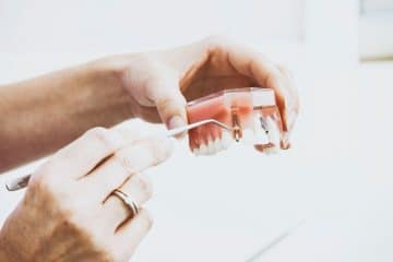 Common Dental Solutions For Missing Teeth