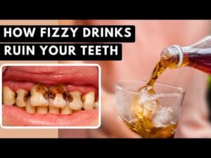 Are Sugar-Free Drinks Damaging Your Teeth Without You Knowing?
