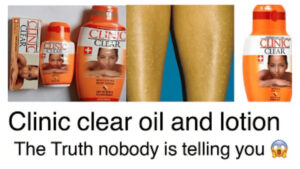 Clinic Clear Lotion Review