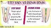 Endodontics: 6 Step back technique steps with diagram 