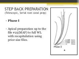 Step back preparation