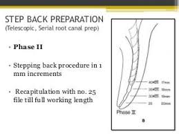 Step Back Preparation