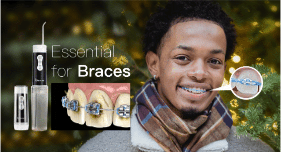 How To Improve Oral Hygiene With Braces