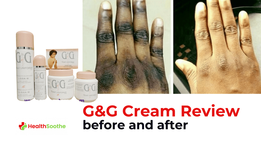 G&G Cream Review