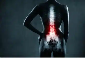 Different Types of Spine Surgery