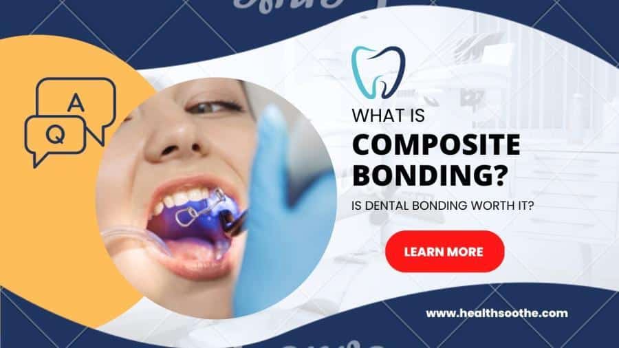 What is Composite Bonding? Is Dental Bonding Worth it?