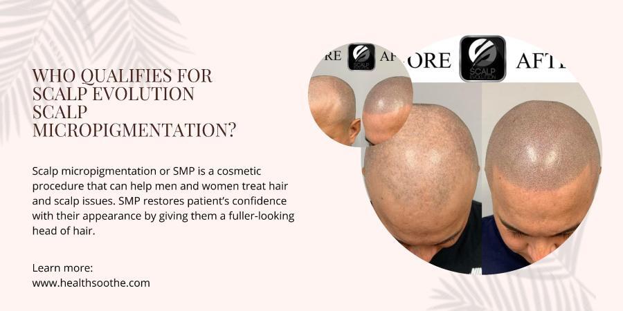 Who Qualifies for Scalp Evolution Scalp Micropigmentation?