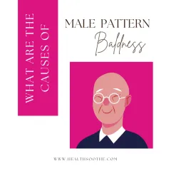 male pattern baldness