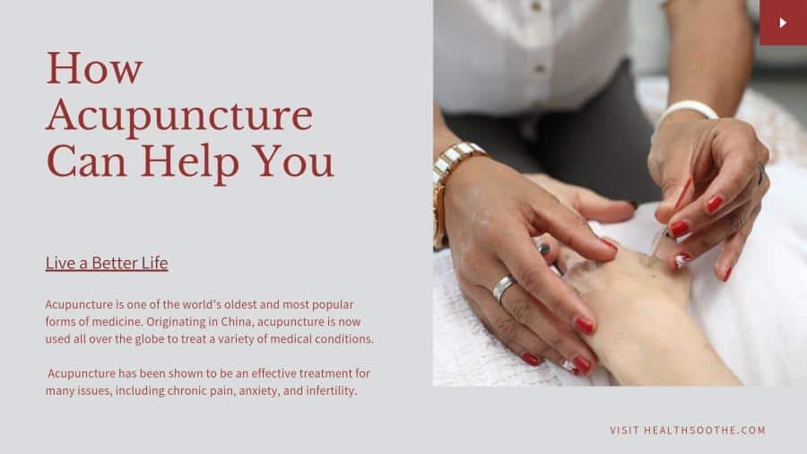 How Acupuncture Can Help You Live a Better Life