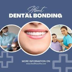 Dental bonding