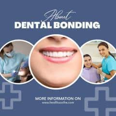Dental Bonding