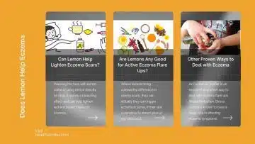 Does Lemon Help Eczema?
