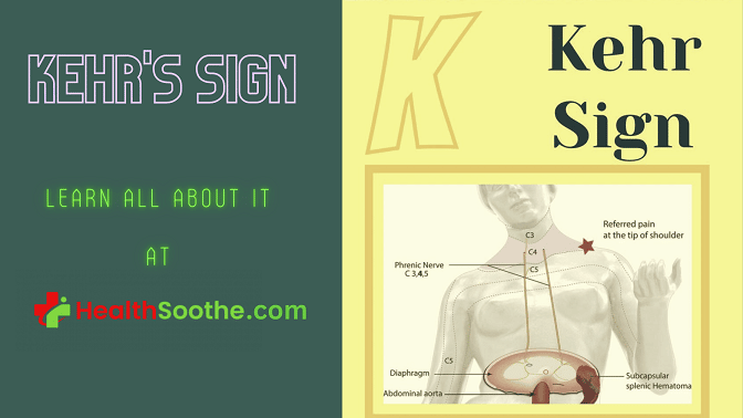 Kehr'S Sign - Healthsoothe