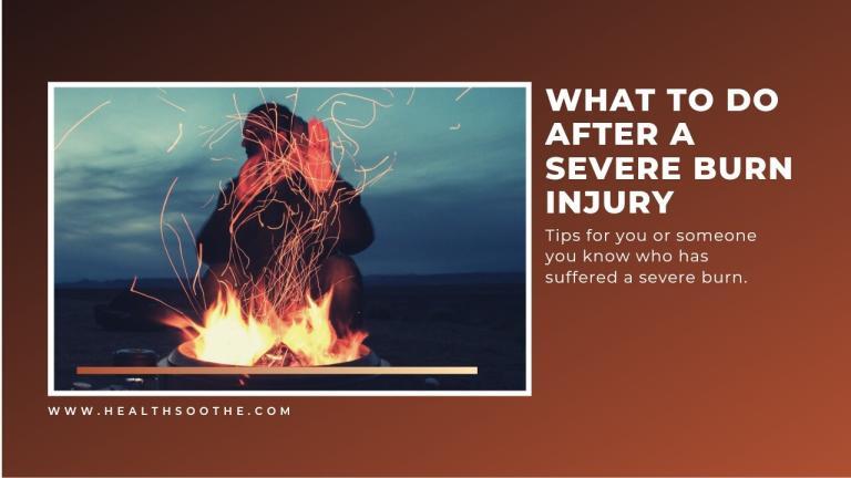 What to Do After a Severe Burn Injury