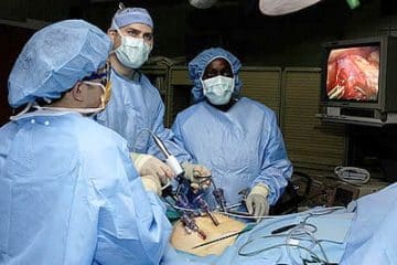 Treatment of appendicitis: laparoscopic surgery - Healthsoothe