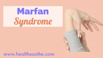 Marfan Syndrome