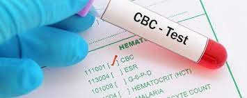 MCH BLOD TEST: CBC TEST - Healthsoothe