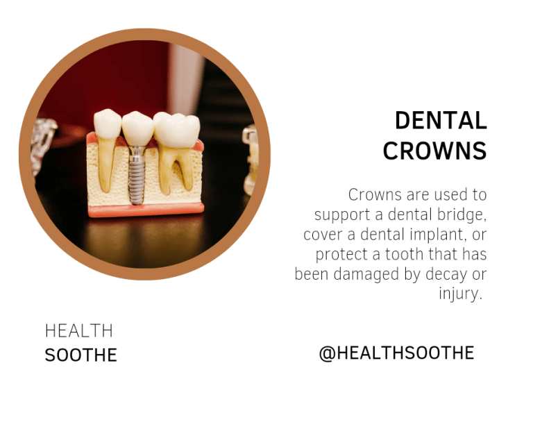 Dental Crowns: The Basics