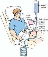 Ink Poisoning Treatment: Irrigation Of The Whole Bowel - Healthsoothe