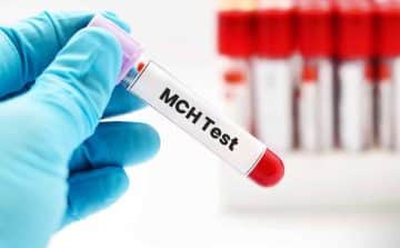 MCH BLOD TEST - Healthsoothe