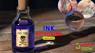 ink poisoning - Healthsoothe