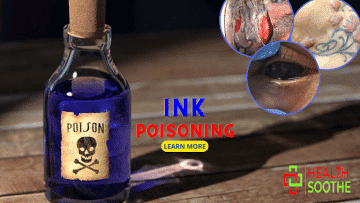 Ink Poisoning - Healthsoothe