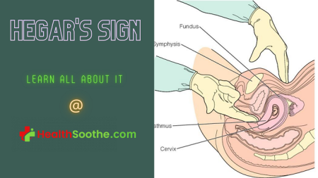 hegar's sign - Healthsoothe