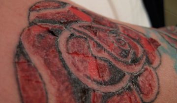 Tattoos and ink poisoning - Healthsoothe