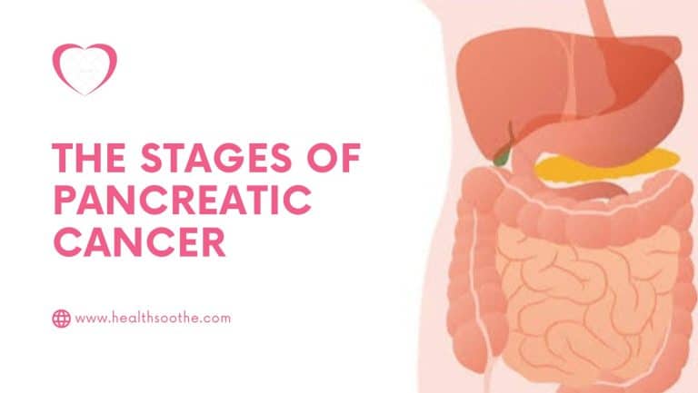 Pancreatic Cancer: Causes, Symptoms, and Susceptibility