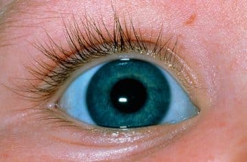 Blue Sclera - Healthsoothe