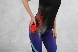 The trochanter: Trochanteric Bursitis - Healthsoothe