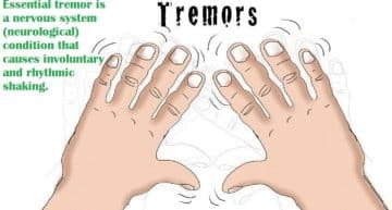 How To Stop Fidgeting: Fidgeting And Essential Tremors - Healthsoothe