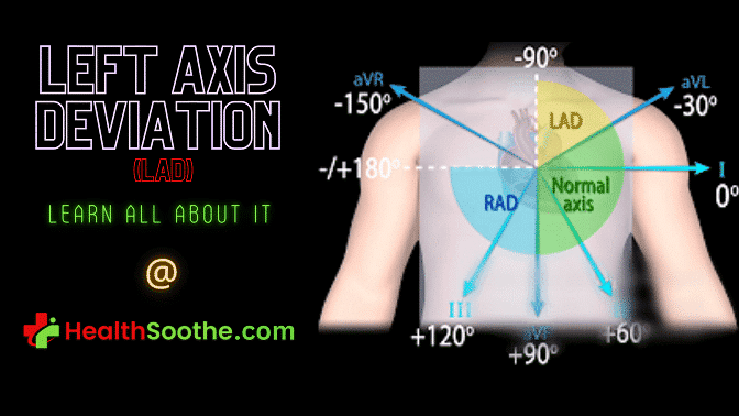 Left Axis Deviation - Healthsoothe