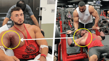 How To Flex Pecs: Pecs Injury - Healthsoothe