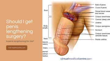 Should I get penis lengthening surgery?