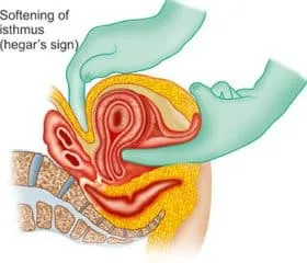what causes hegar's sign - Healthsoothe