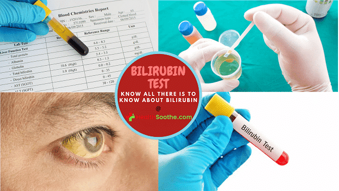 bilirubin - Healthsoothe