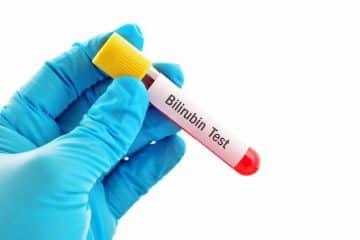 bilirubin test - Healthsoothe