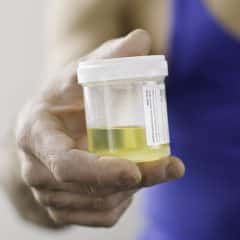epithelial cells in urine - Healthsoothe