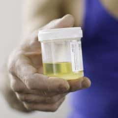 Epithelial Cells In Urine - Healthsoothe
