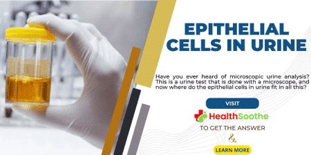 epithelial cells in urine - Healthsoothe
