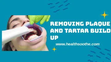 plaque-and-tartar