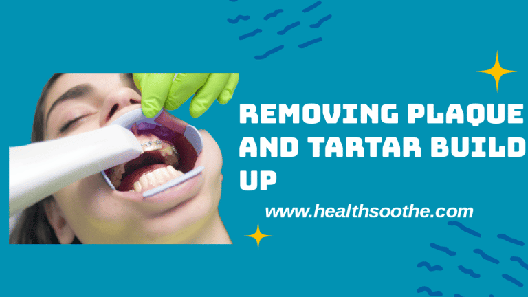 plaque-and-tartar