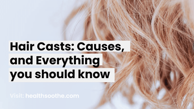 Hair Casts: Causes, And Everything You Should Know