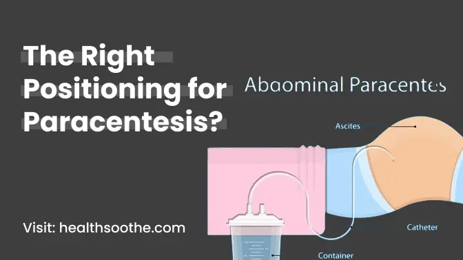 The Right Positioning for Paracentesis