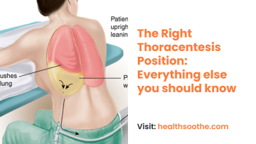The Right Thoracentesis Position
